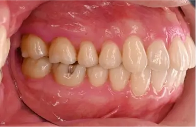 症例A 施術後写真その2