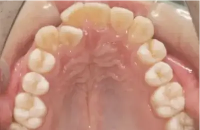 症例B 施術前写真その3