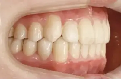 症例B 施術後写真その2