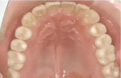 症例B 施術後写真その3