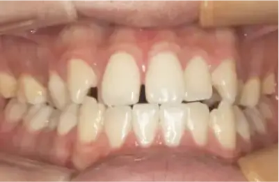 症例C 施術前写真その1