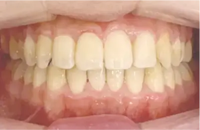 症例C 施術後写真その1