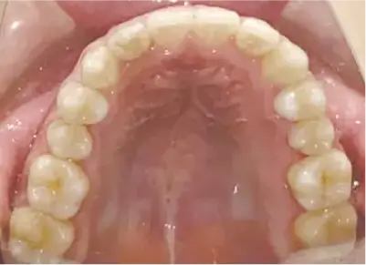 症例C 施術後写真その2