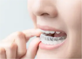 治療前処置と装置の装着イメージ