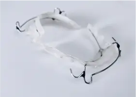 保定・経過観察イメージ